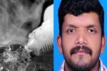 ಕಾಸರಗೋಡು : ಯುವತಿಯ ಮೇಲೆ ಆಸಿಡ್ ದಾಳಿ ನಡೆಸಿ ಯುವಕ ಆತ್ಮಹತ್ಯೆಗೆ ಶರಣು